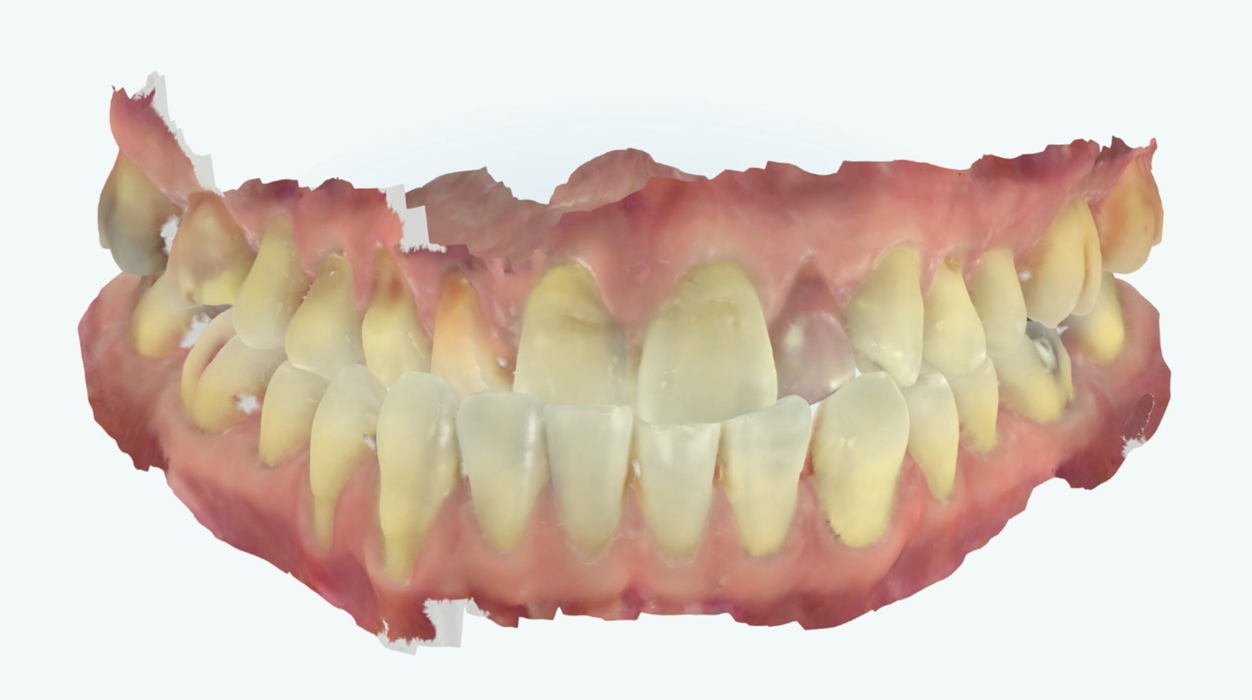 Second Day_TrioClear Align and Restore_Slider_4