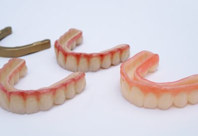 All-On-X_Removable_Overlays and Suprastructure