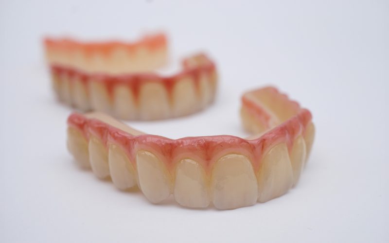 All-On-X_Removable_Teeth Overlays
