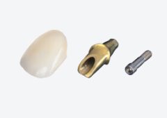 Preisbeispiele-Abutments-1 Preisbeispiele-Abutments-1
